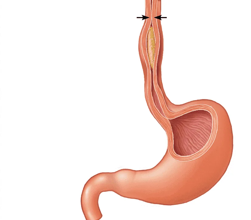 Мышечная стенка пищевода. Сфинктер желудка и пищевода. Пищевод и желудок анатомия человека. Нижепишеволный сфинктер.